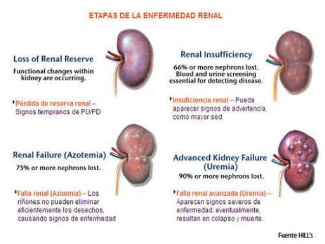 enfermedad poliquistica renal autosomica dominante